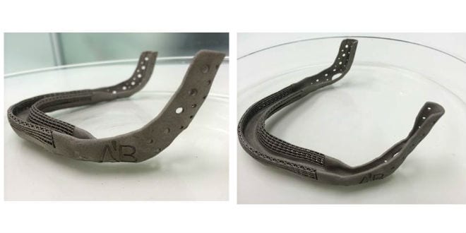 The specially made titanium jaw made by doctors at Rambam Medical Center. (Photo: RHCC)